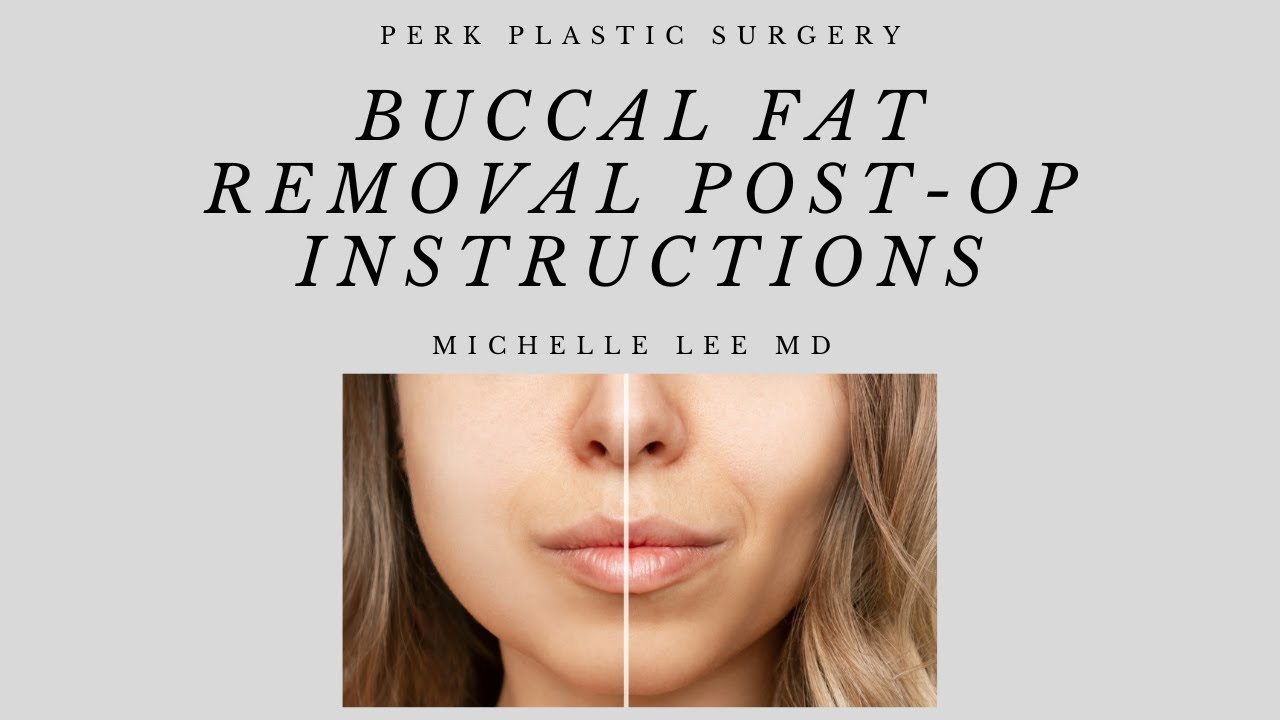 Buccal Fat Removal Post-Operative Instructions
