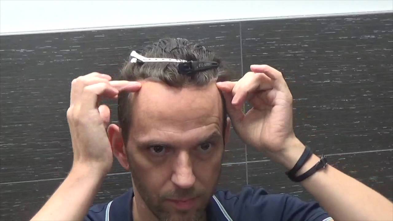 Glueing down your hair system
