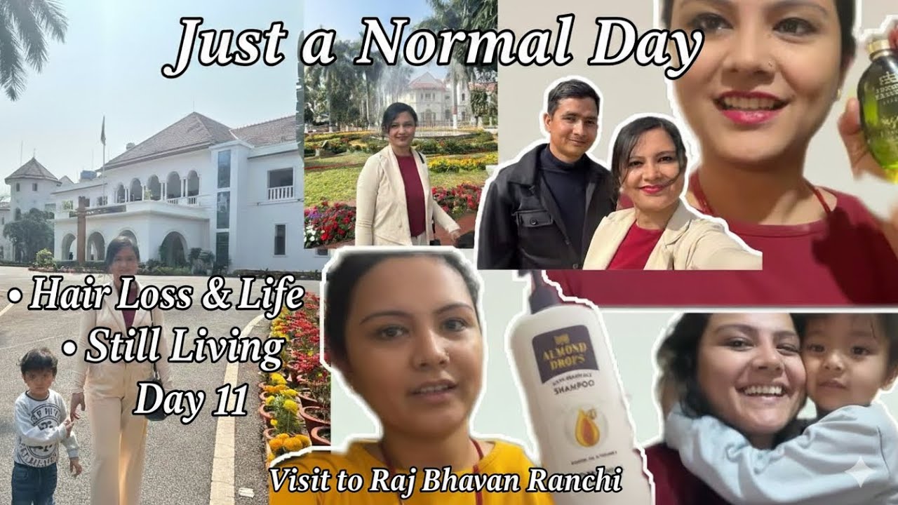 Living with Hair Loss | Raj Bhawan Ranchi Visit | Daily Hair Vlog Day 11 @Thefamilyatra  