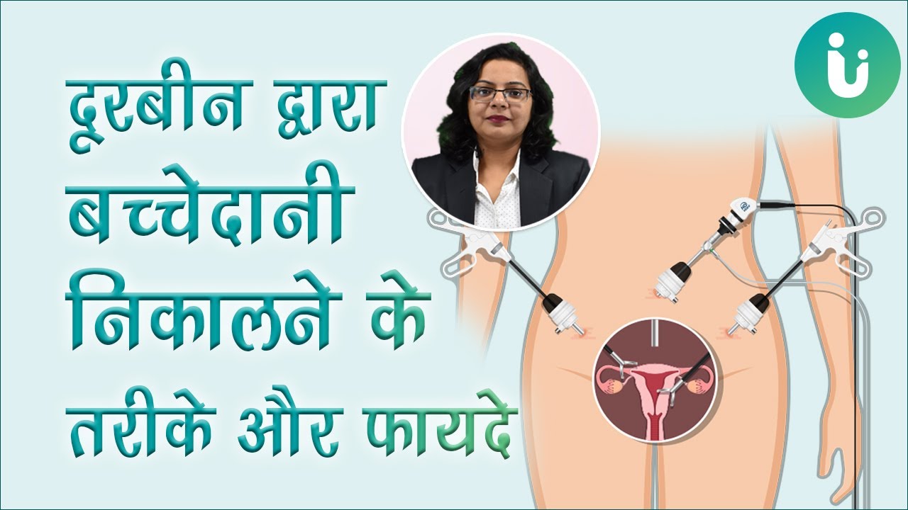 दूरबीन द्वारा बच्चेदानी निकालने का ऑपरेशन कब, क्यों, कैसे किया जाता है और फायदे- Dr. Pulkit Nandwani