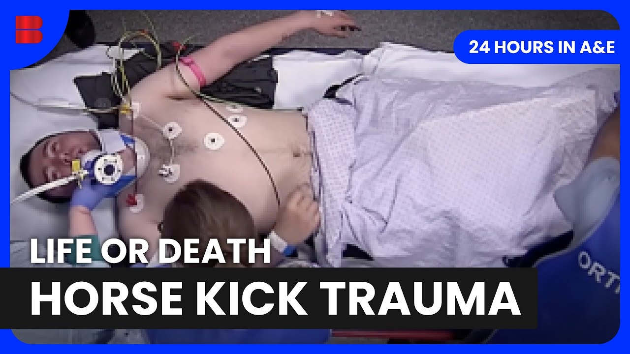 Horse Kick Trauma St Georges Emergency Department | 24 Hours in A&E