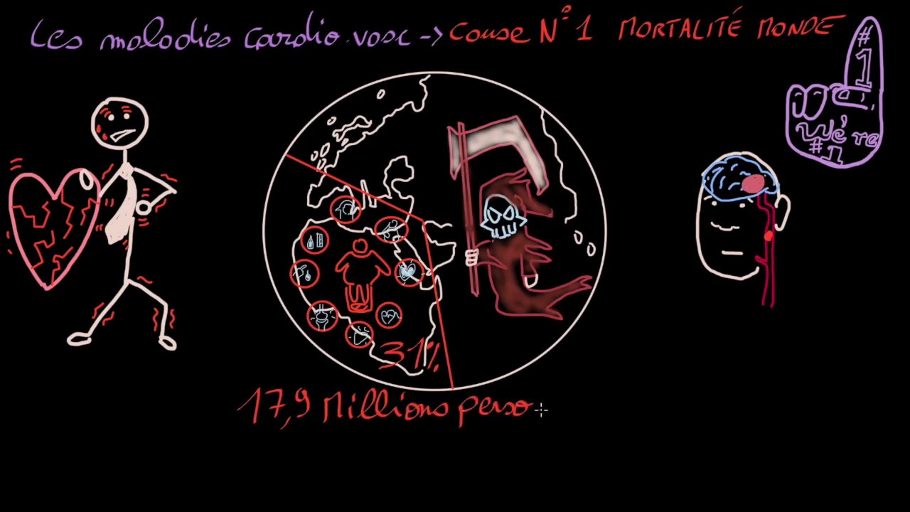 Infarctus vs connerie - Docteur Synapse