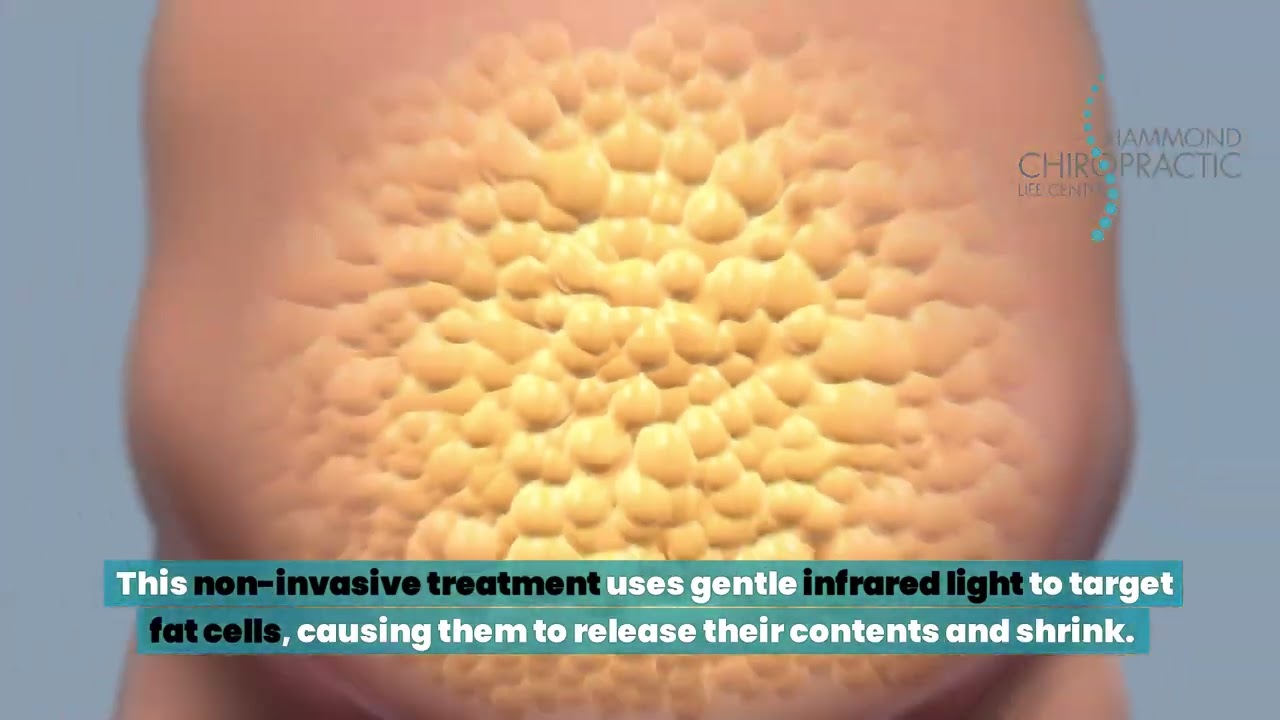 Contour Light for Weight Loss at Hammond Chiropractic
