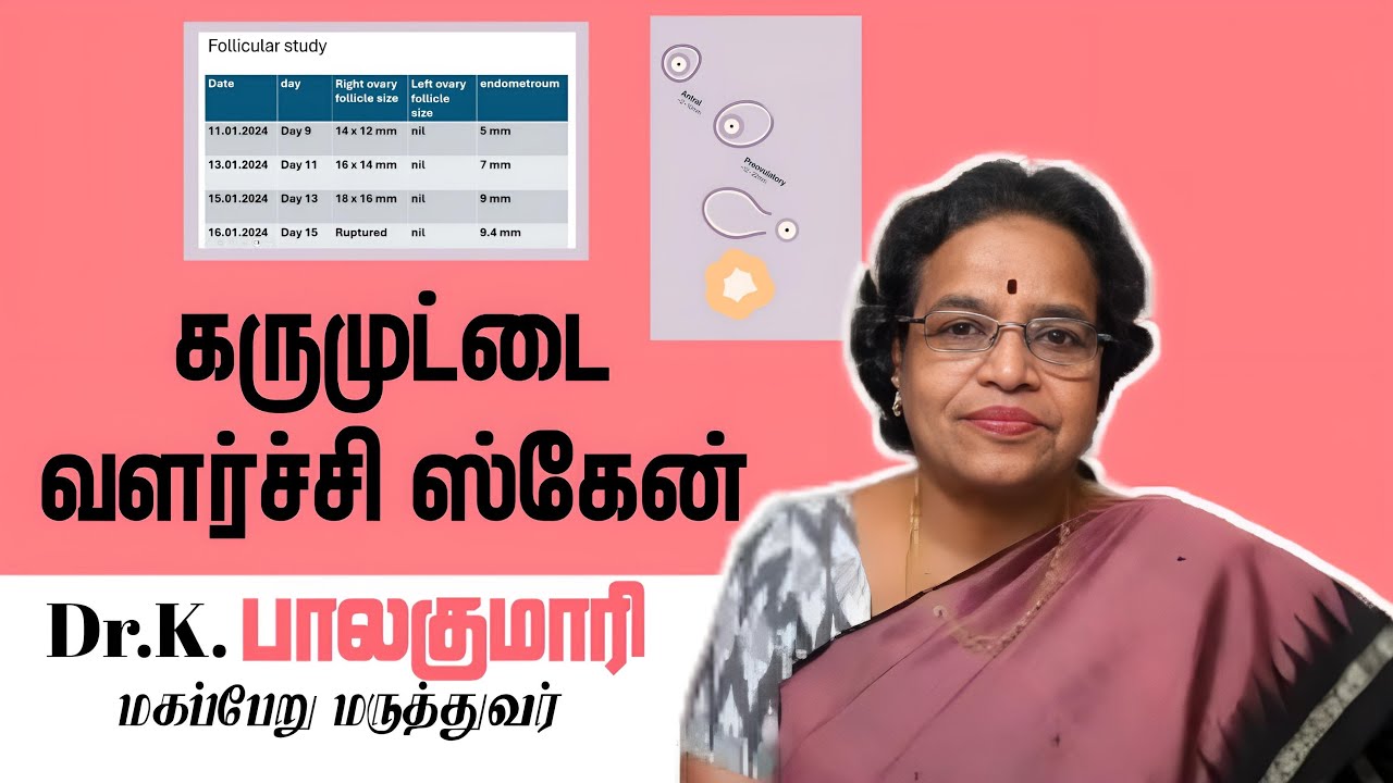 Follicular study - கரு முட்டை வளர்ச்சி ஸ்கேன்