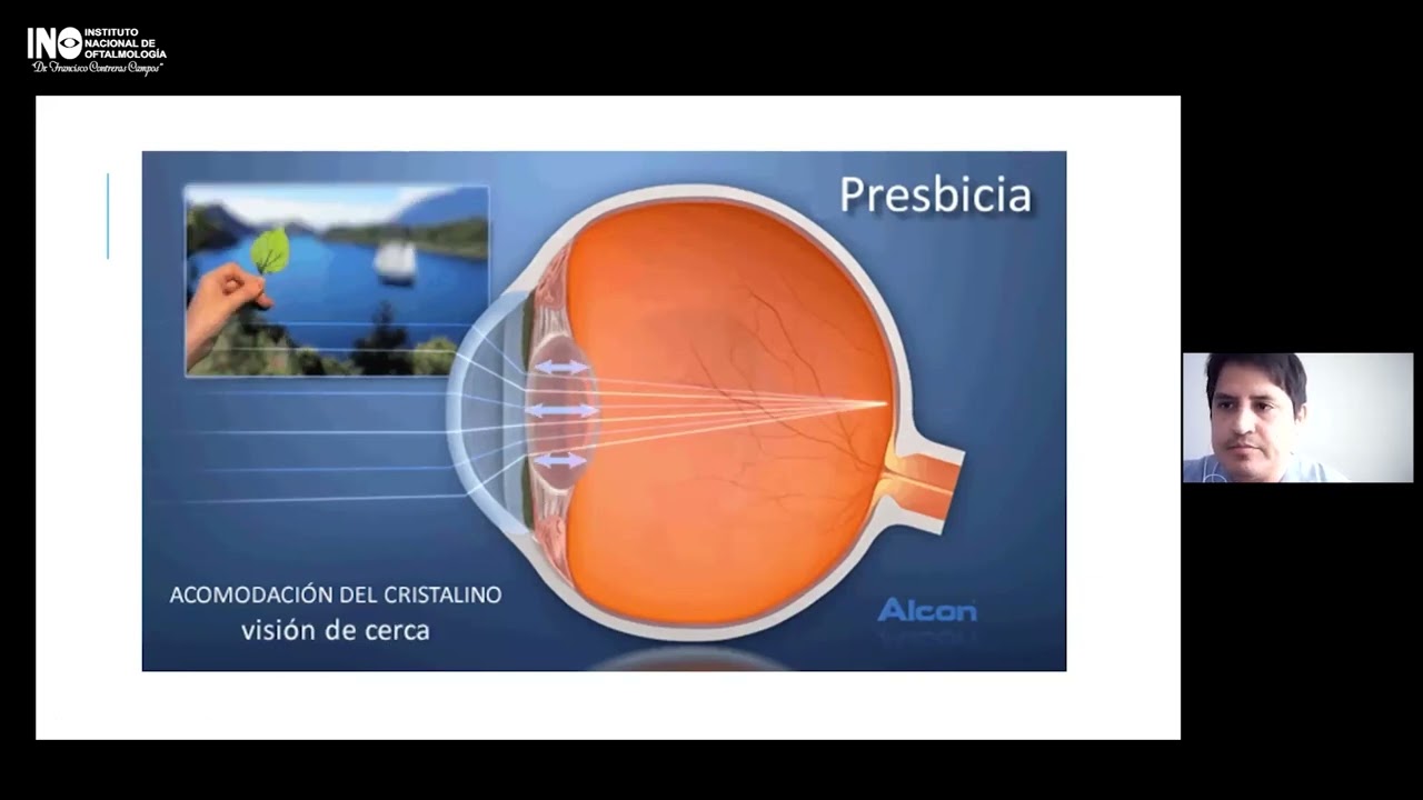 SALUD OCULAR EN LINEA FATIGA VISUAL Y USO DE LENTES CORRECTORES