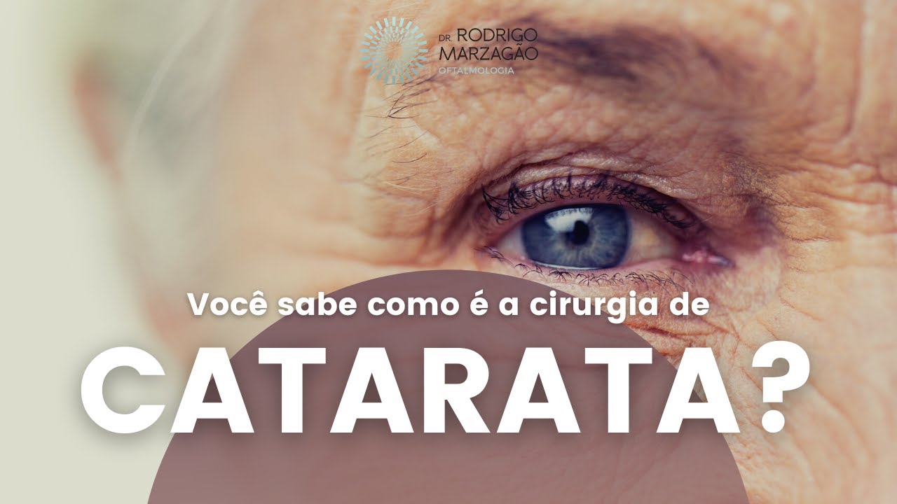 Voc&ecirc; sabe como &eacute; a cirurgia de catarata? - Joinville - SC