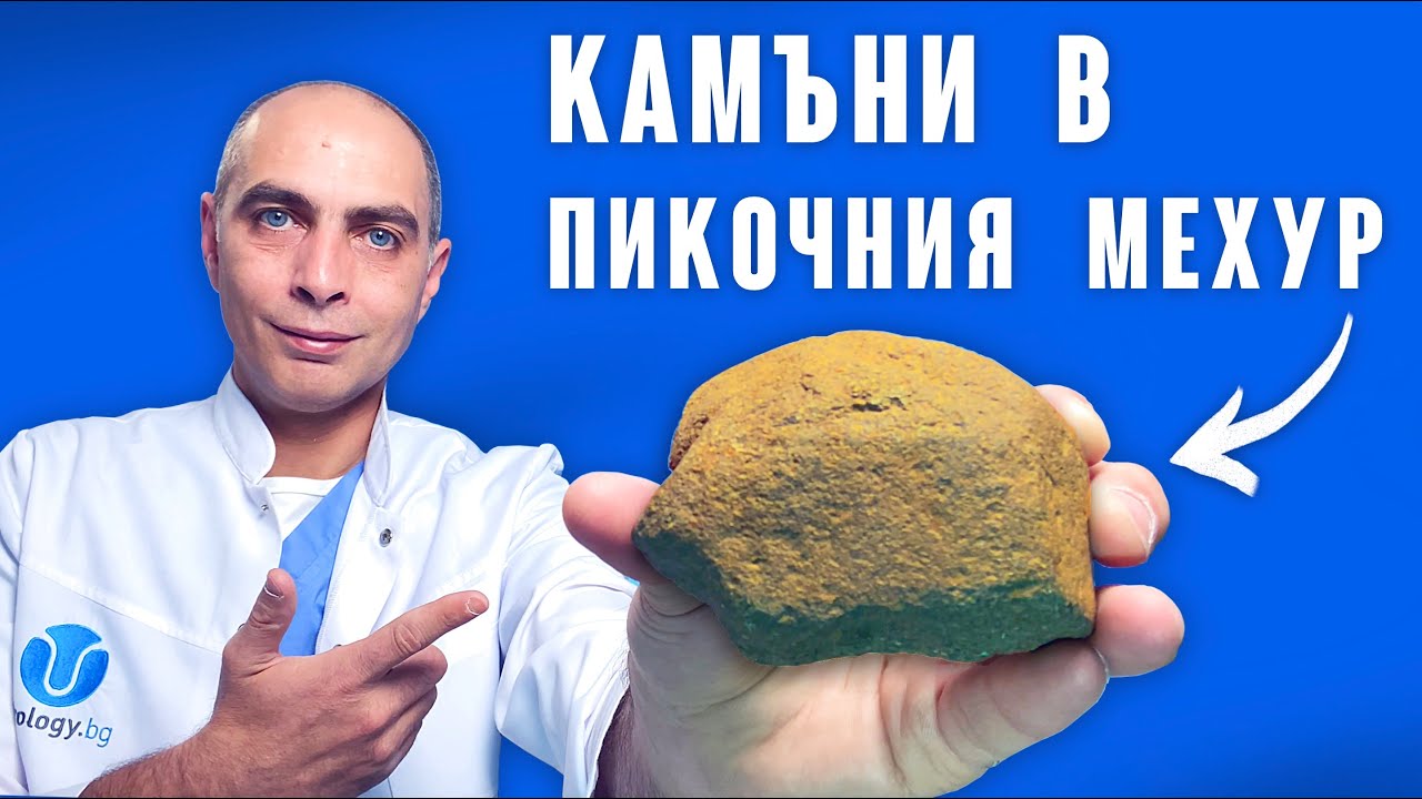 Камъни в Пикочния Мехур - Как и Защо се Образуват?!