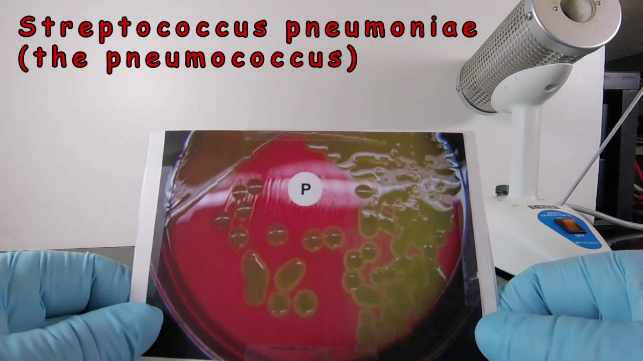 Alpha Hemolysis and Identification of Streptococcus pneumoniae