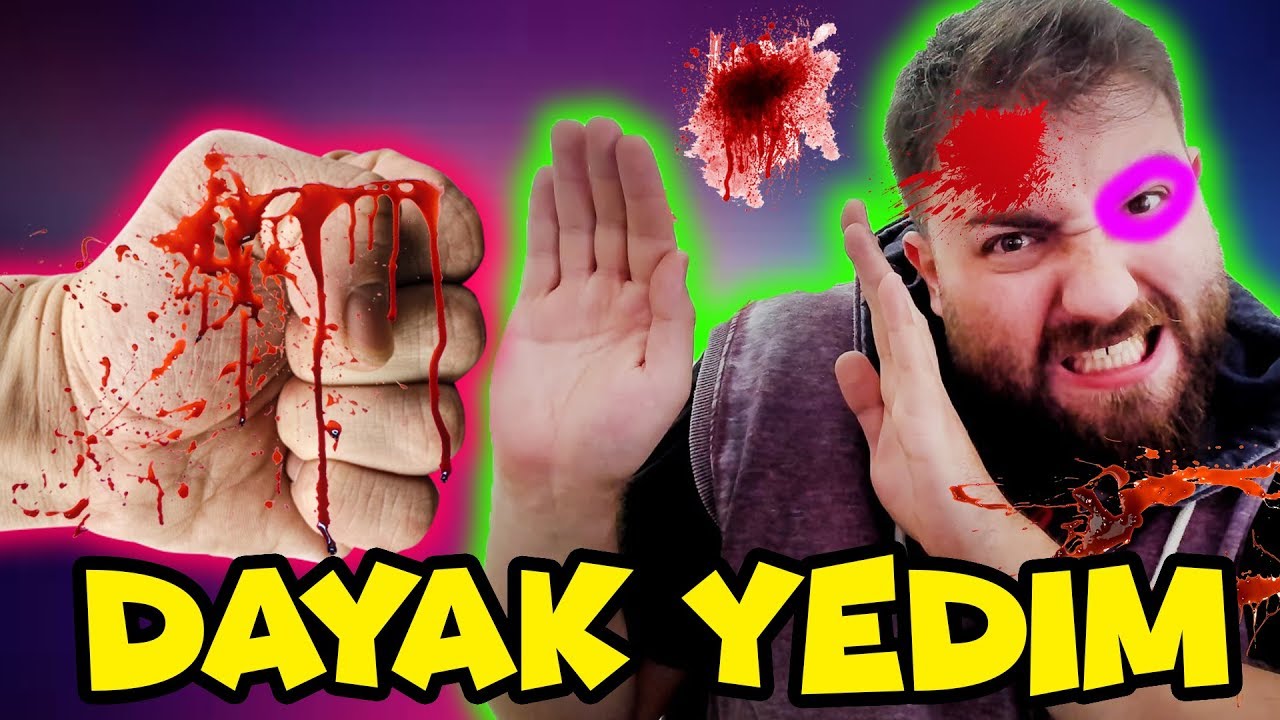 Ağzımı Burnumu Kırdılar | Gang Beasts