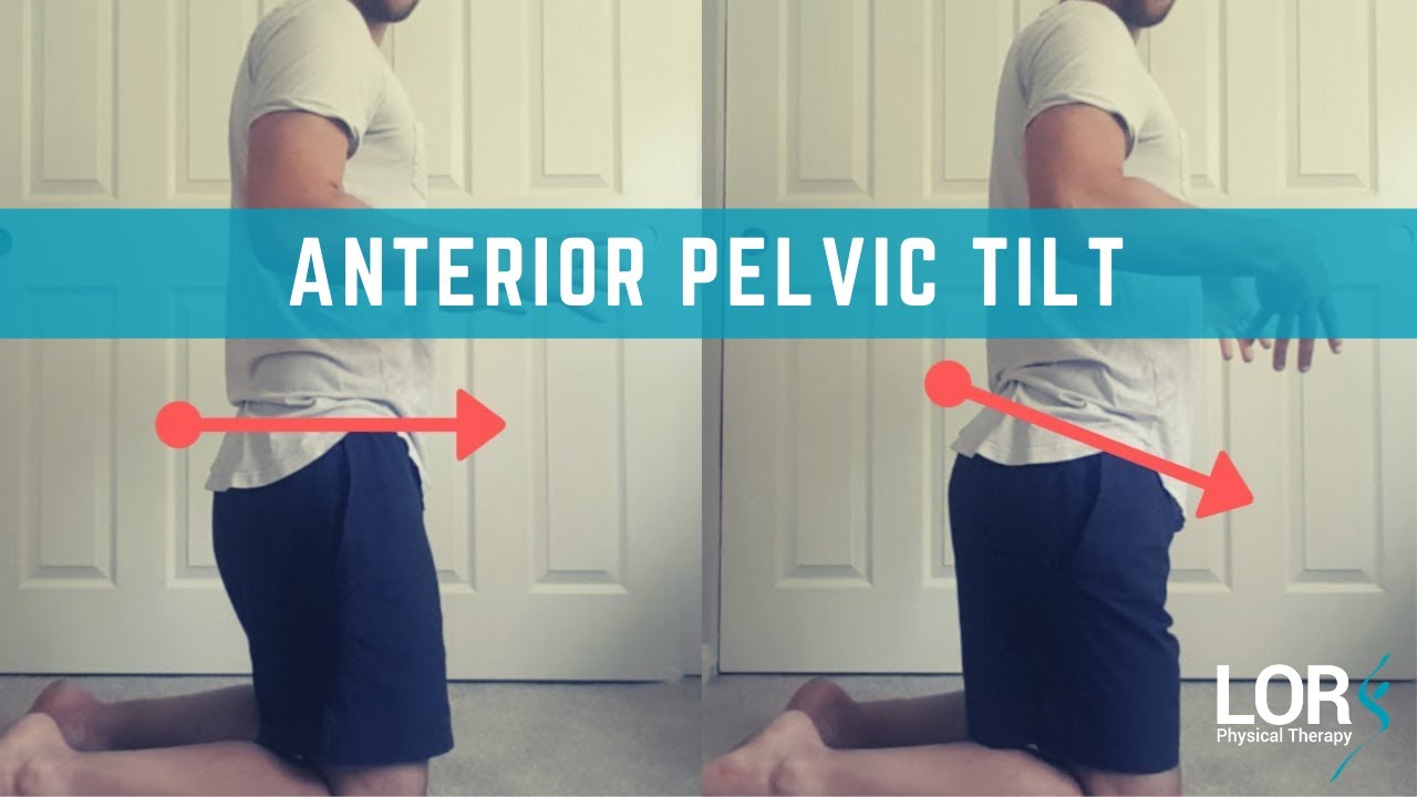 Quick Test For Anterior Pelvic Tilt, and Why It's SO important to Rectify - LOR Physical Therapy