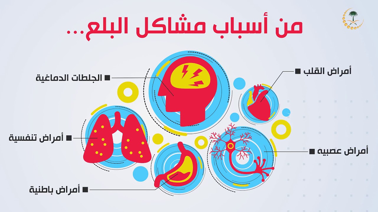 صعوبة البلع