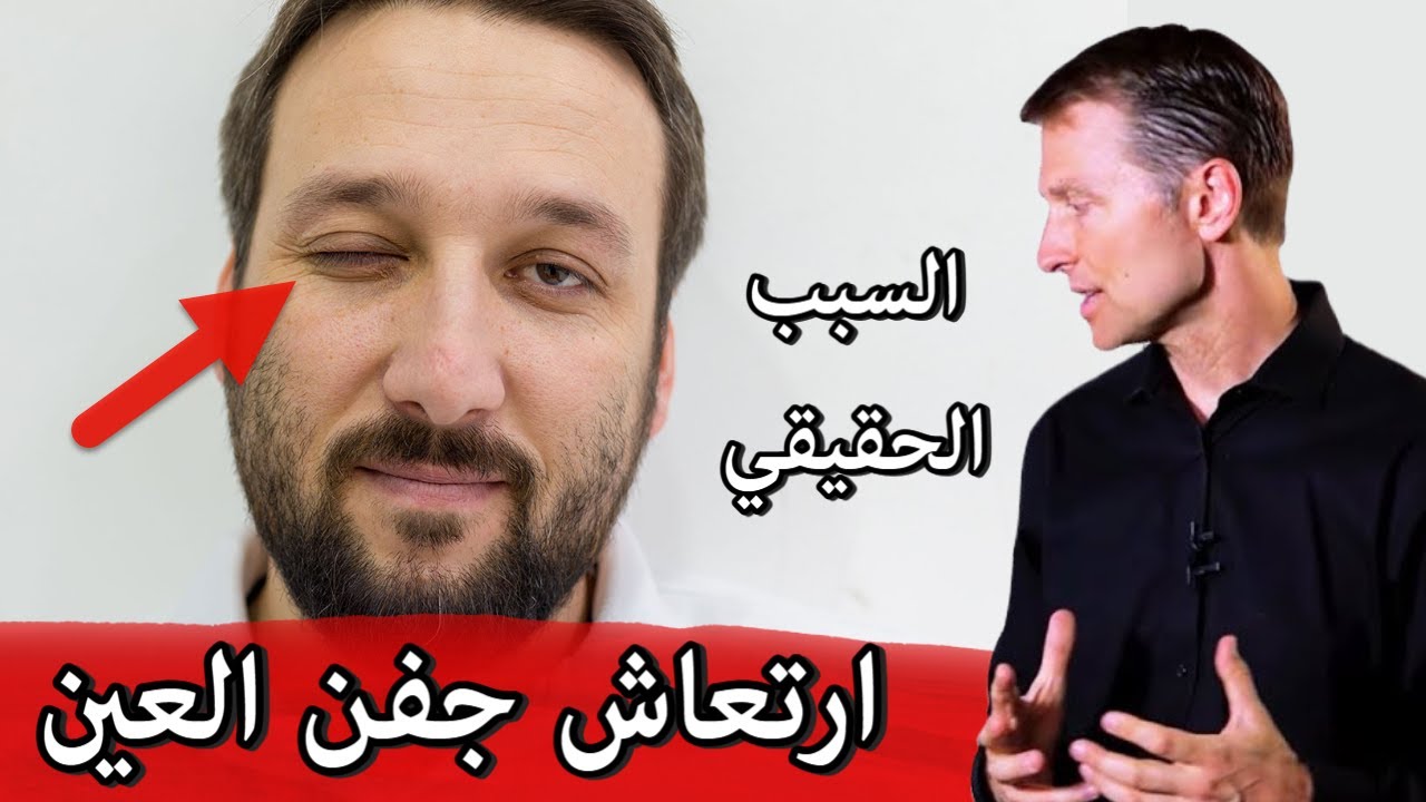 السبب الحقيقي وراء ارتعاش وتشنجات جفن العين واليد والشفاه