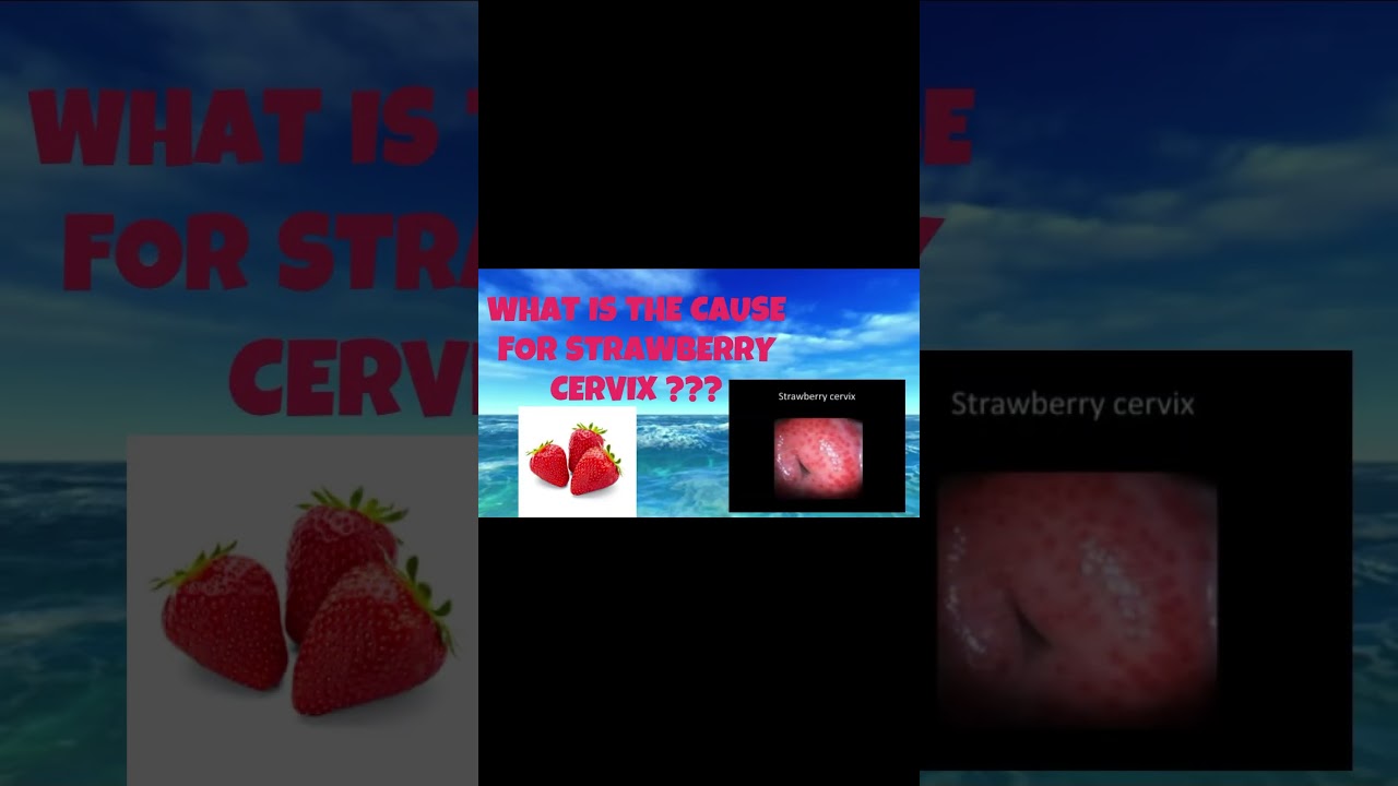 Did You Know? The Startling Reality of Strawberry Cervix | 