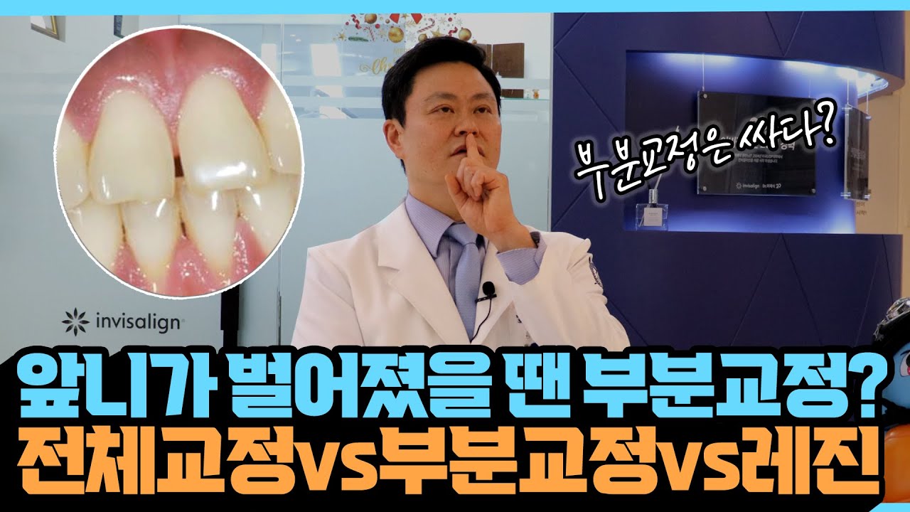 [교정일타 허원장] 앞니가 벌어졌을 땐 부분교정? 전체교정vs부분교정vs레진