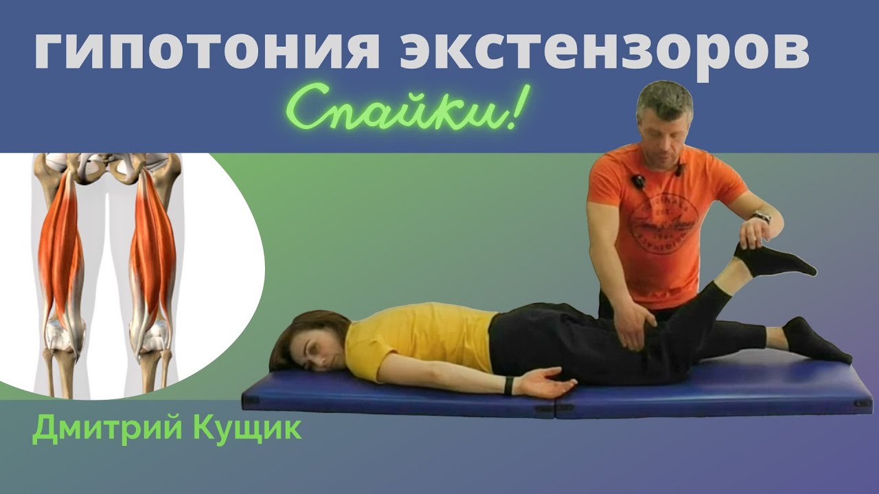 СПАЙКИ | ГИПОТОНИЯ ЭКСТЕНЗОРОВ | ТБС | Кинезиолог Дмитрий Кущик