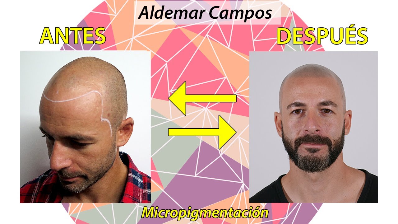 (ENG SUB) Antes y después de la micropigmentación
