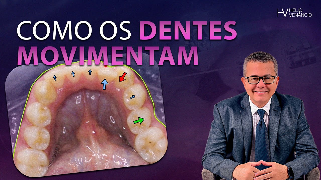 Como os dentes movimentam? | ORTODONTIA | Prof. Hélio Venâncio