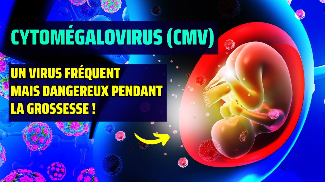 Le Cytomégalovirus (CMV) : causes, symptômes, traitements et prévention expliqués simplement