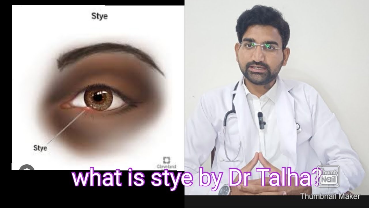 what is stye by Dr Talha???