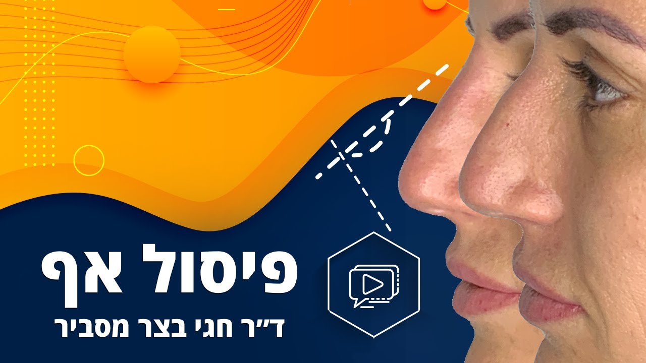 פיסול אף ללא ניתוח – כל מה שאת צריכה לדעת – ד