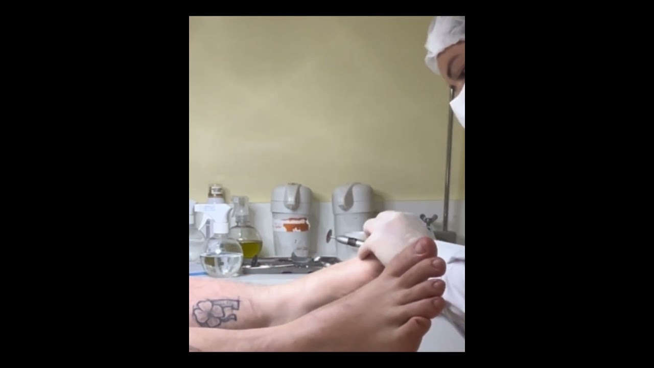 Foot Spa &ndash; Gentle Podiatry Finish Session #FootSpa #Podiatry #relax #ASMRFeet #massage #footmassage