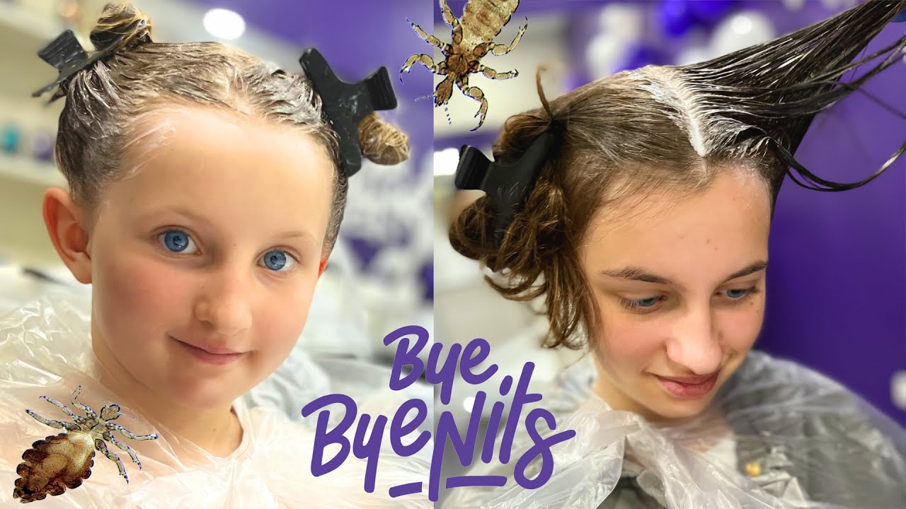 ON A DES POUX !!! COMMENT S'EN DÉBARRASSER ? - Bye Bye Nits