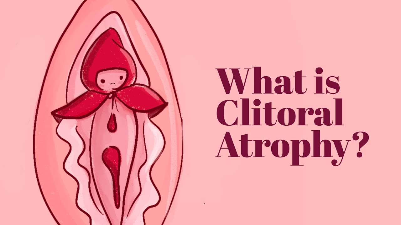 What is Clitoral Atrophy - Causes & Remedies