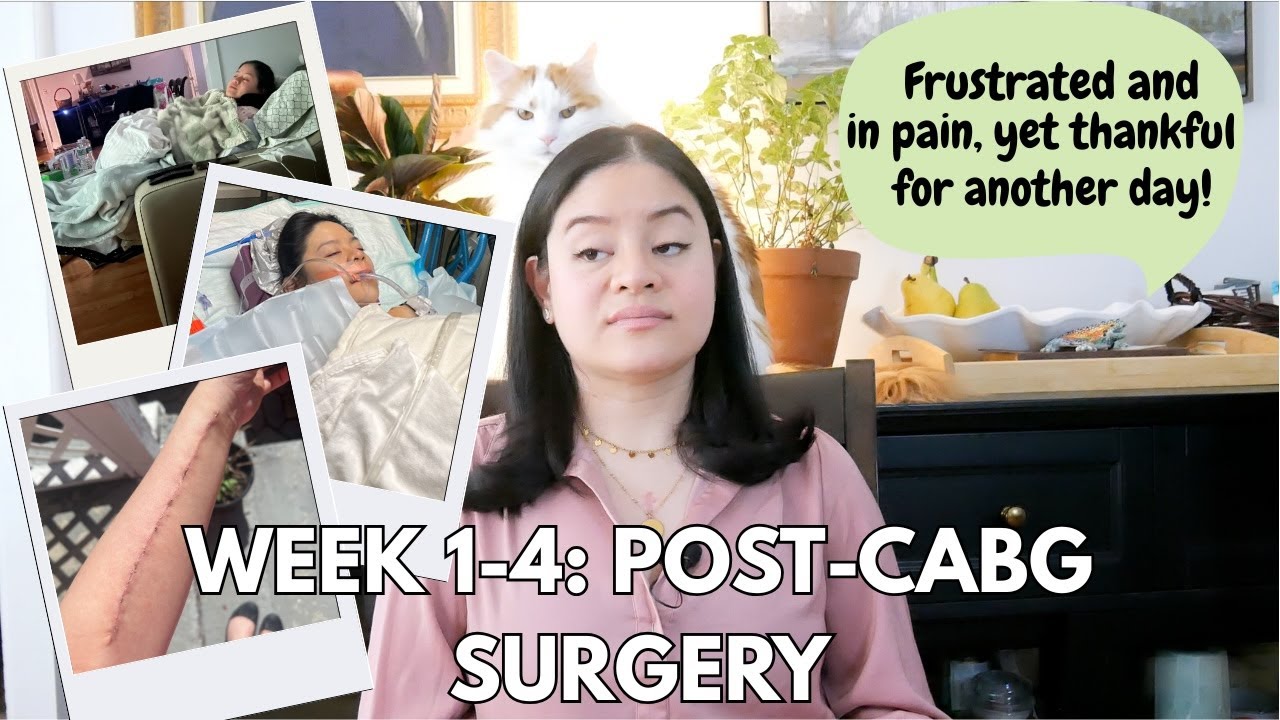 My Open-Heart Triple Bypass Recovery - The First Four Weeks