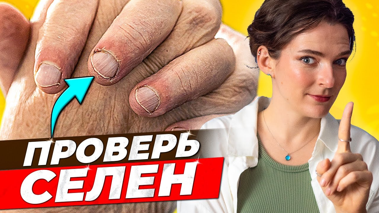 ✅ ПОЛЬЗА И ❌ ВРЕД СЕЛЕНА || Кому нужен селен, как определить дефицит, селен при гипотиреозе