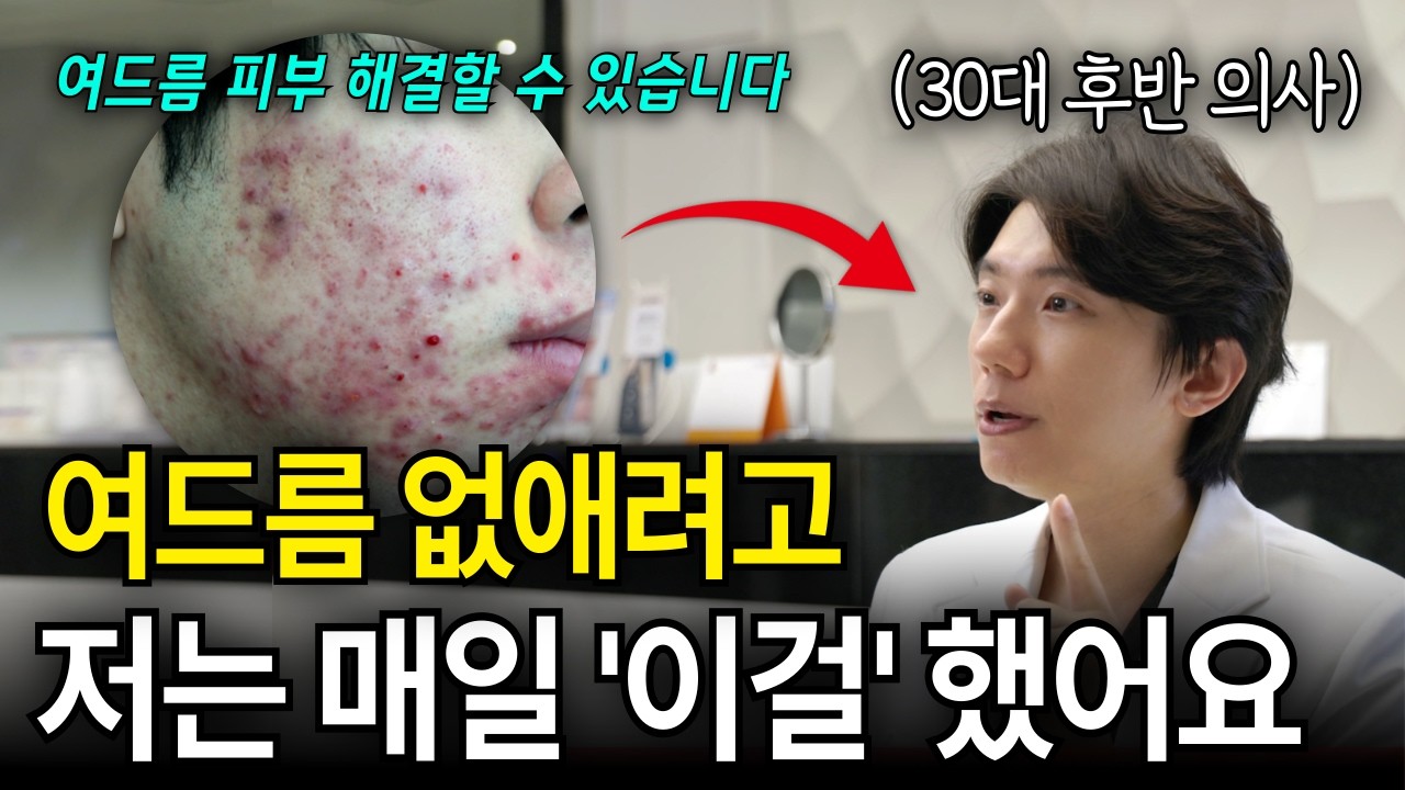 여드름피부, 매일 '이렇게' 했더니 동안피부 되고 10살을 젊어졌습니다.ㅣ[창원피부과, 창원여드름치료]