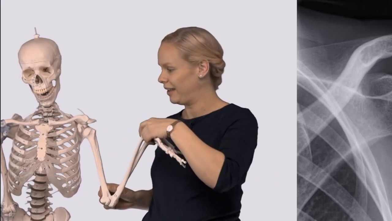 Skjelett: Overekstremiteten - del 1