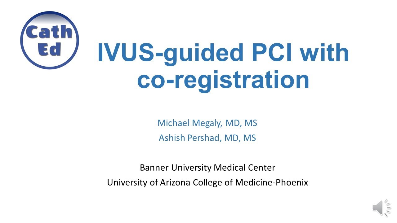 A step-by-step approach to IVUS-guided PCI with co-registration