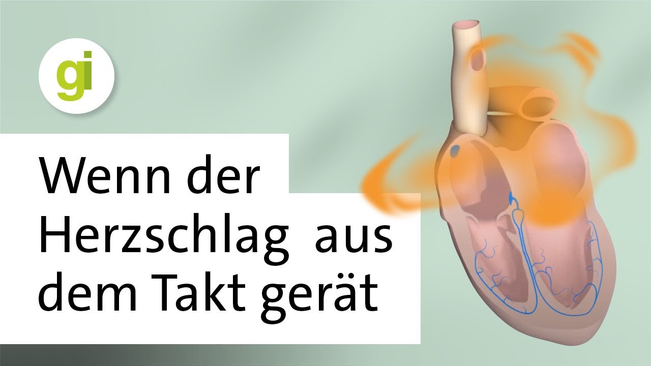 Die h&auml;ufigste Herzrhythmusst&ouml;rung: Was ist Vorhofflimmern?