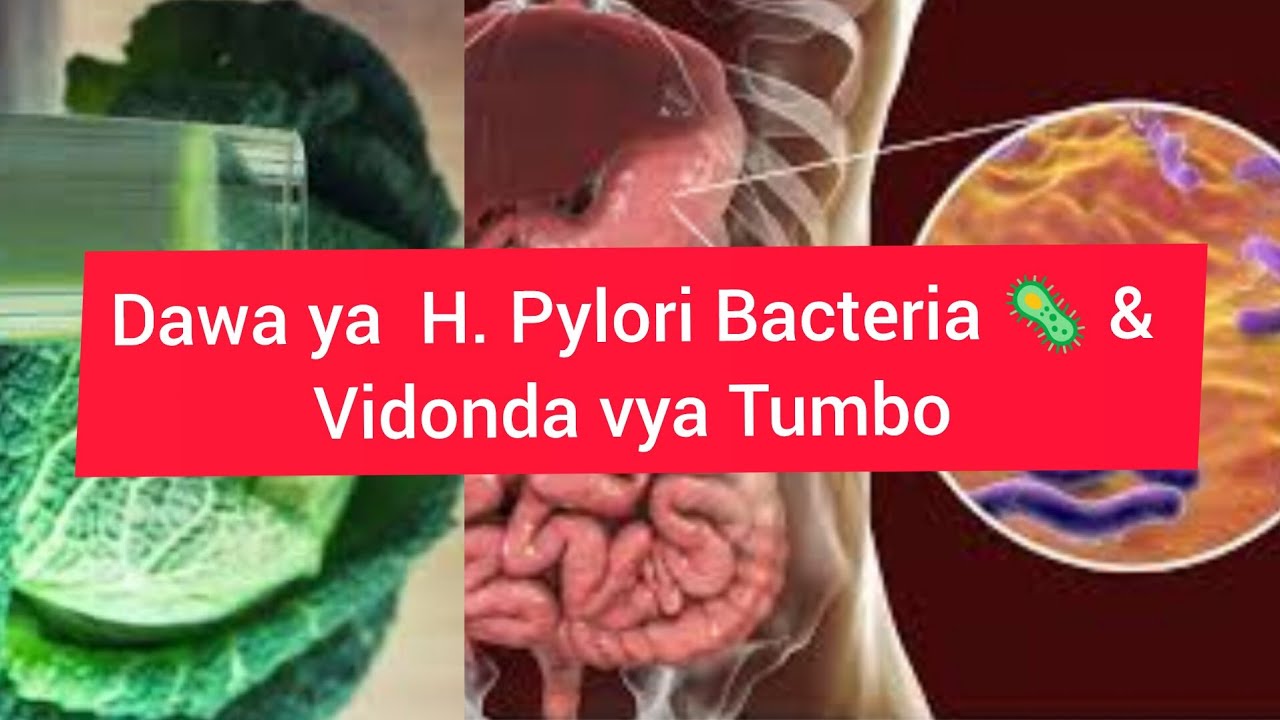 FAHAMU TIBA SAHIHI YA H. PYLORI BACTERIA 🦠 & VIDONDA VYA TUMBO.