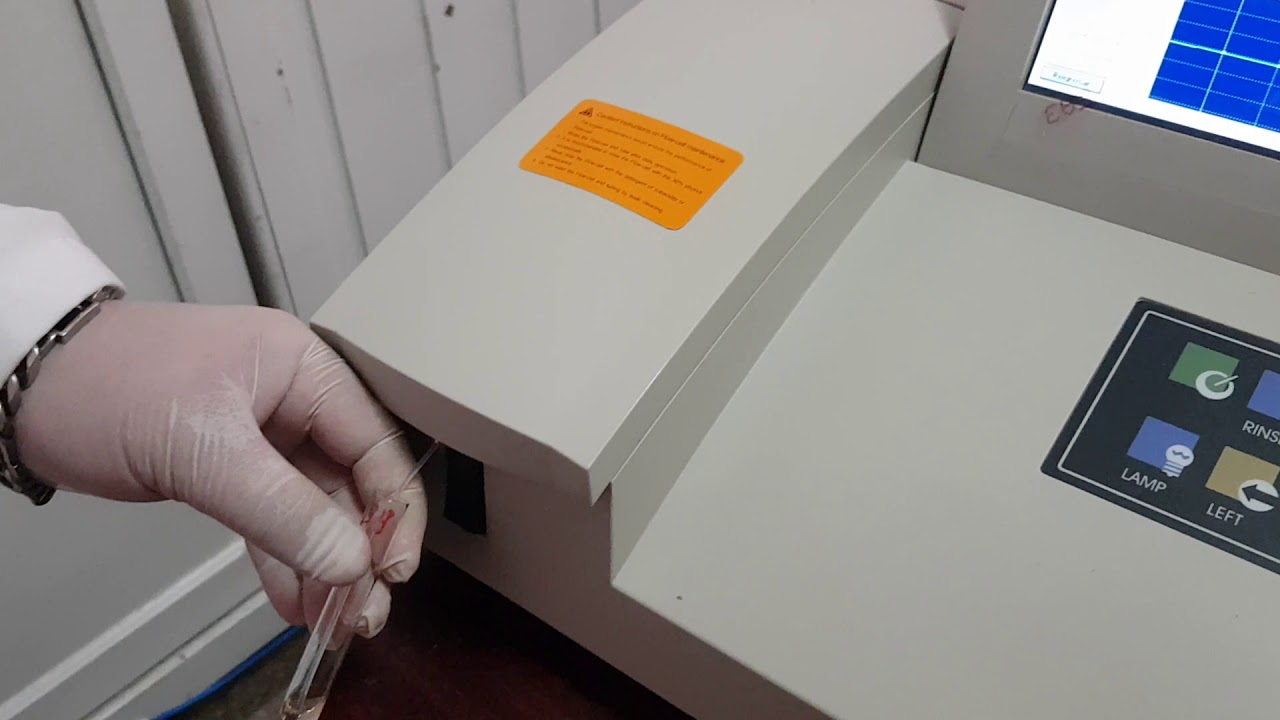 Calibracion Rayto 1904 - Parte 2