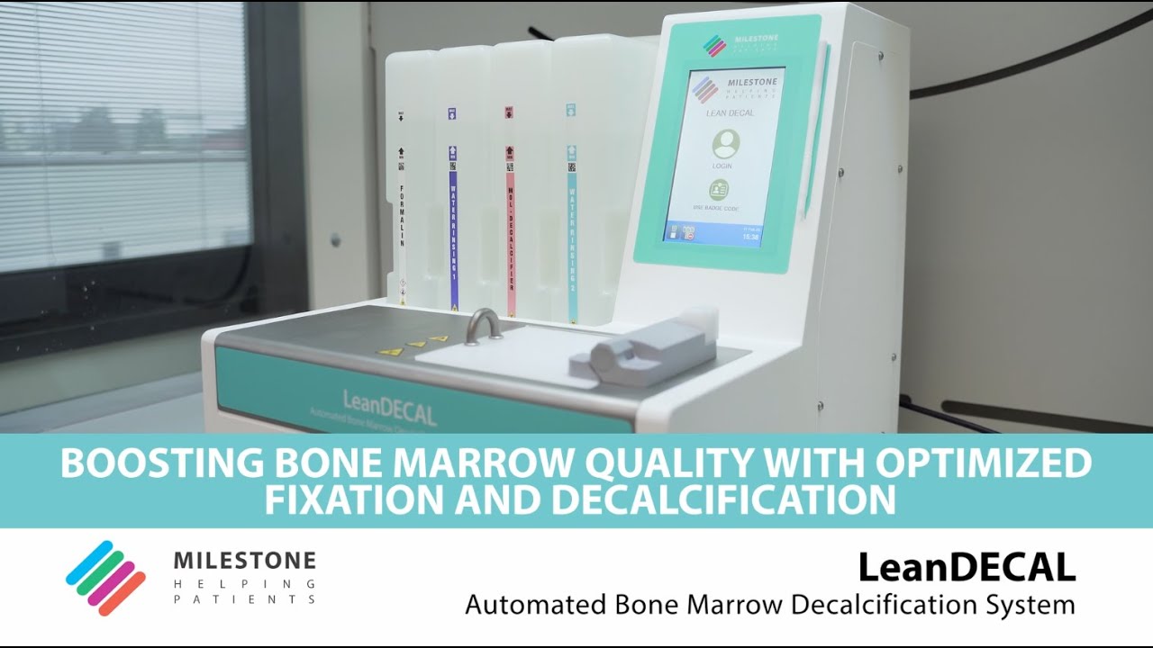 LeanDECAL | Automated Bone Marrow Decalcification System