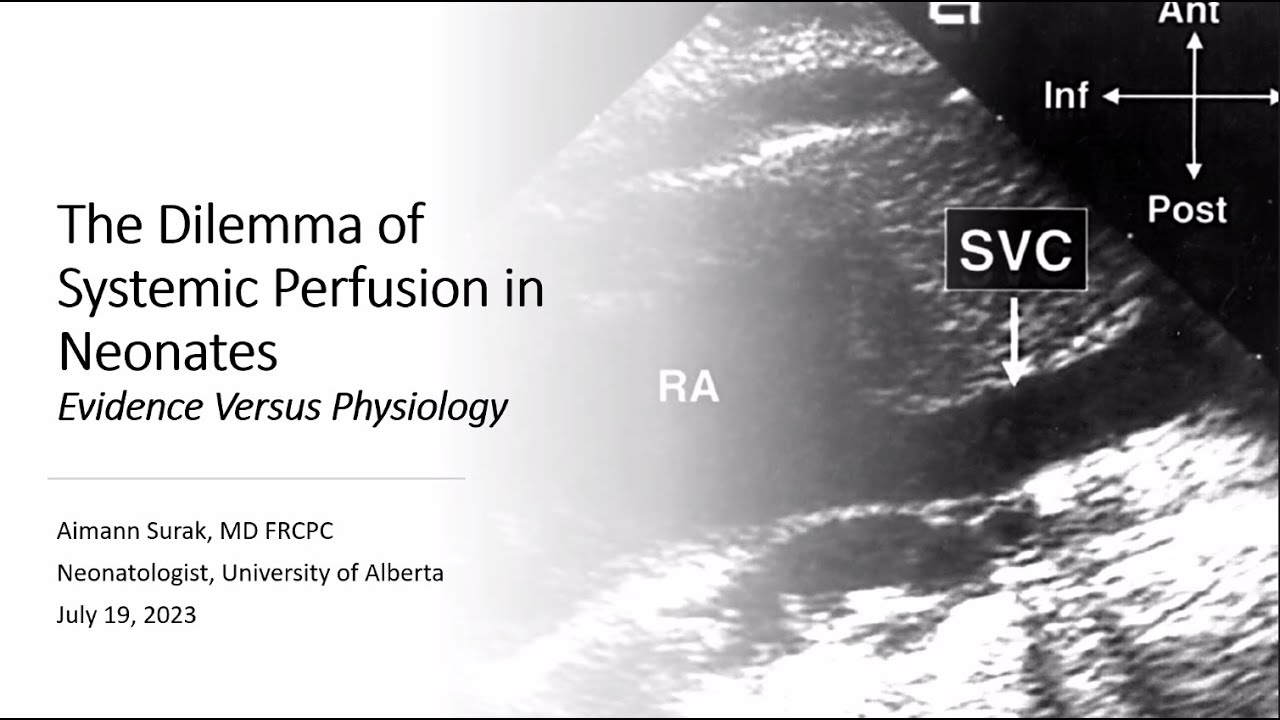 The Dilemma of Systemic Perfusion in Neonates: Evidence versus Physiology