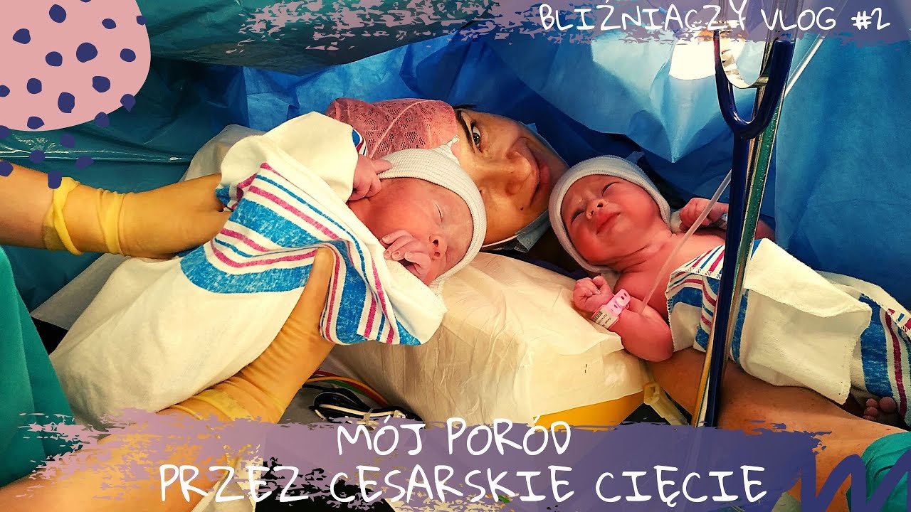 MÓJ PORÓD PRZEZ CESARSKIE CIĘCIE | BLIŹNIACZY VLOG #2