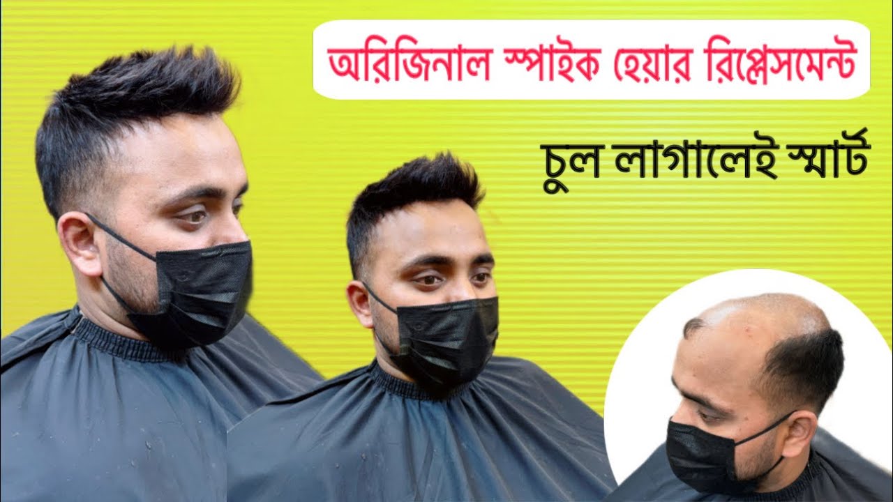 Australia skin bes spike style hair replacement | hair faxing in Bangladesh | styles hair system