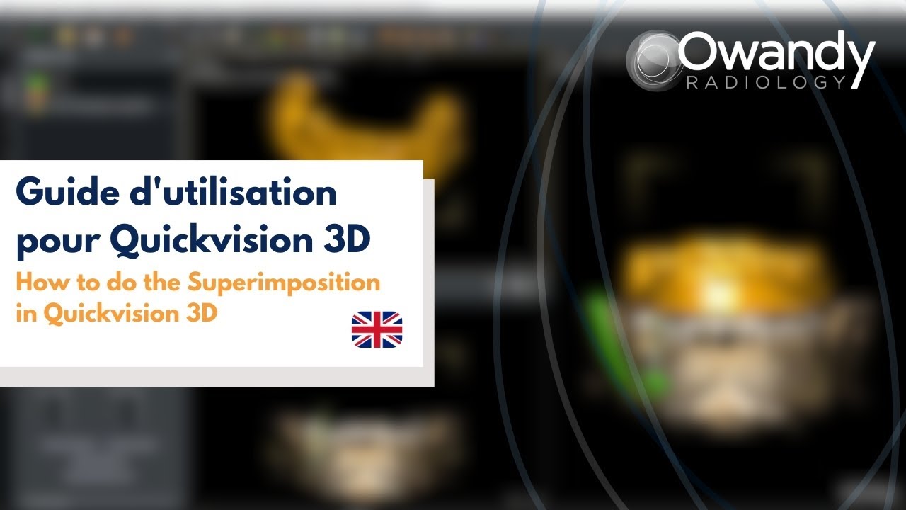 10/ How to do the Superimposition in Quickvision 3D