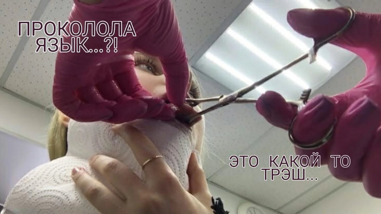 ПРОКОЛ ЯЗЫКА. МОЯ НЕДЕЛЯ.
