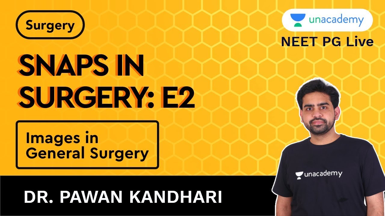 Snaps in Surgery : E2 : General Surgery | Dr. Pawan Kandhari