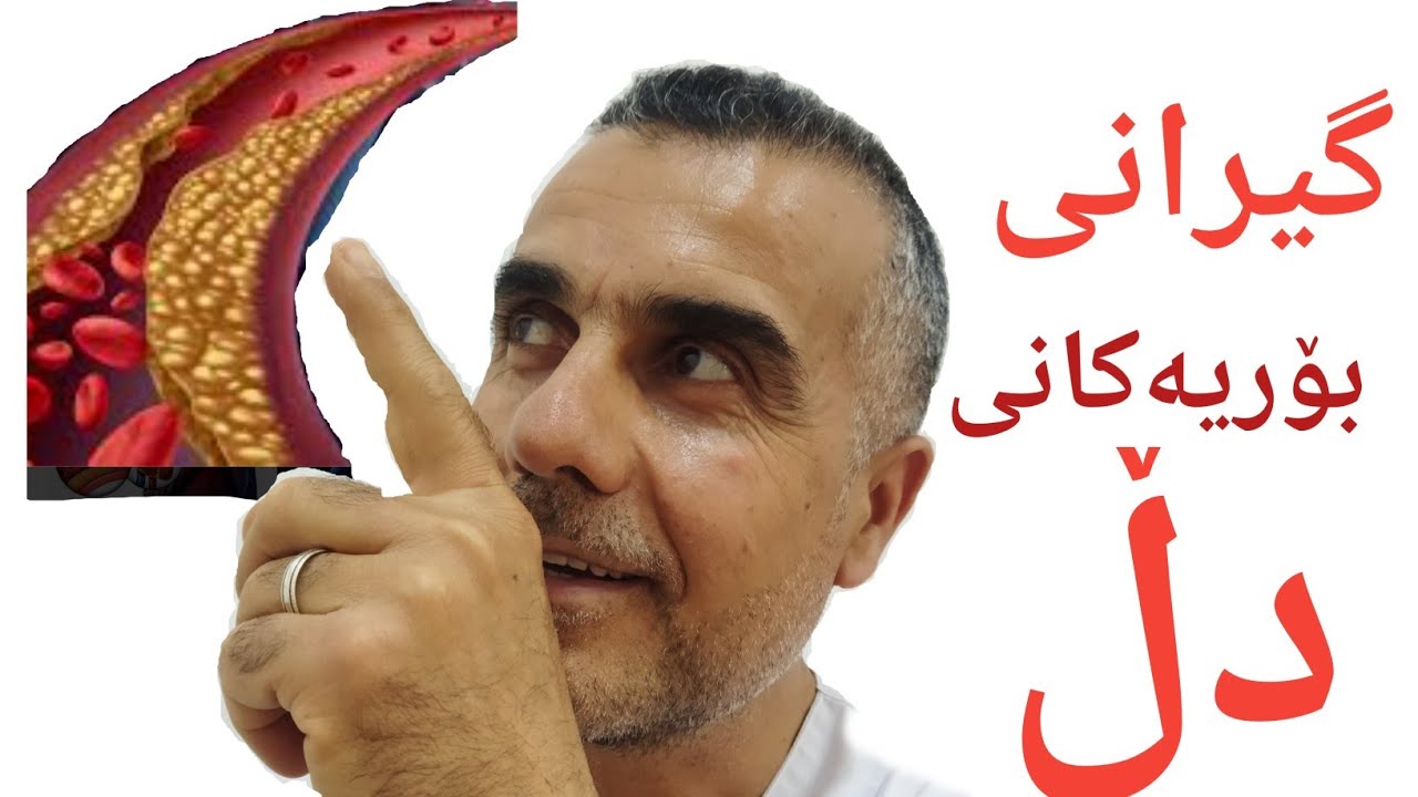 گیرانی بۆریەکانی دڵ.heart stroke #نەخۆشی سەردەم.