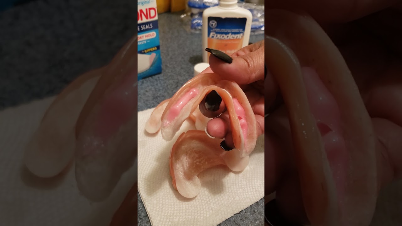 Dentures,SeaBond and Gifting...