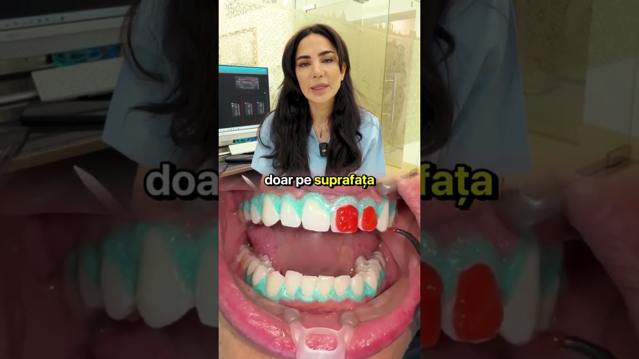 Dr. Mawada Kurbe ne arată pas cu pas cum o albire dentară profesională