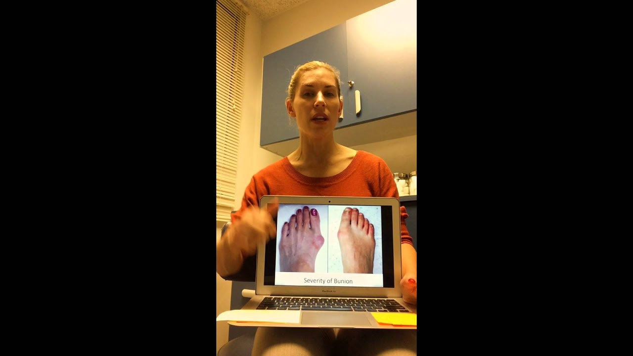 Biomechanics of Bunion Formation with Dr Emily Splichal