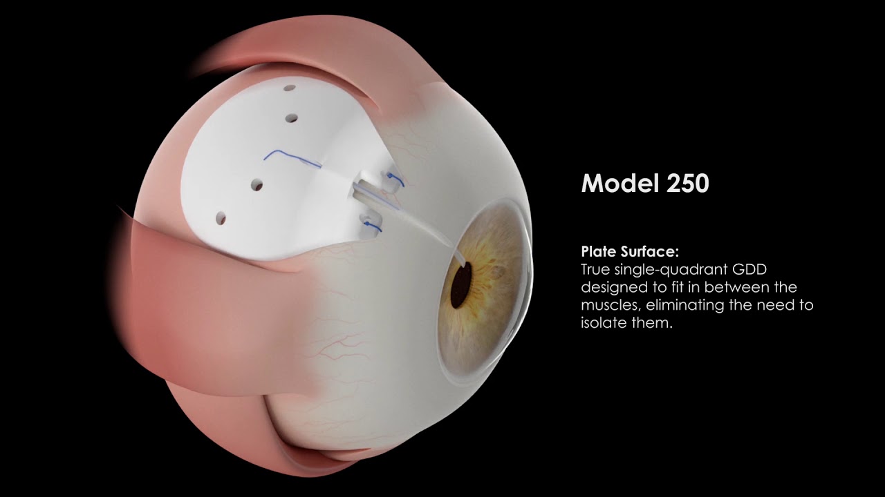 Ahmed ClearPath&reg; Model 250 Animation
