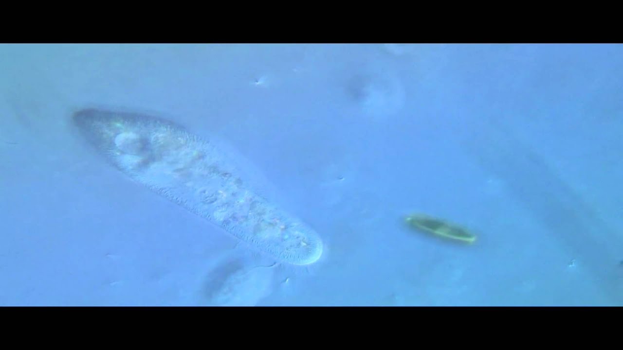 Paramecium caudatum