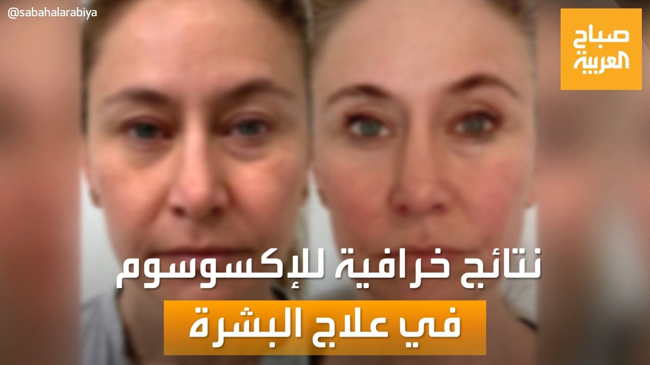 صباح العربية | نتائج صادمة حققها 