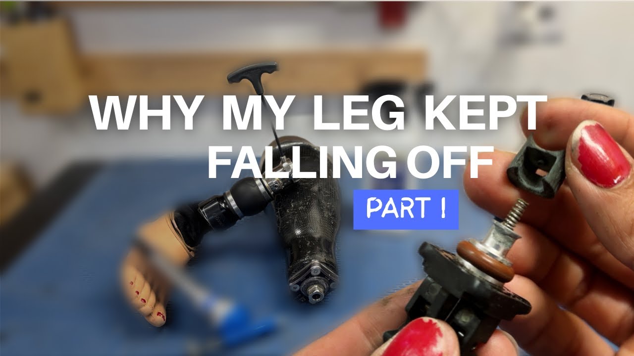 My Prosthetic Leg Kept Falling Off… Here’s What I Found
